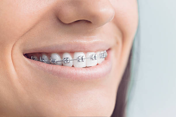 Best Invisalign and Clear Aligners  in Mount Arlington, NJ